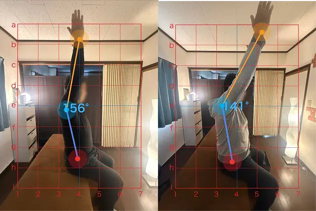肩可動域のビフォーアフター